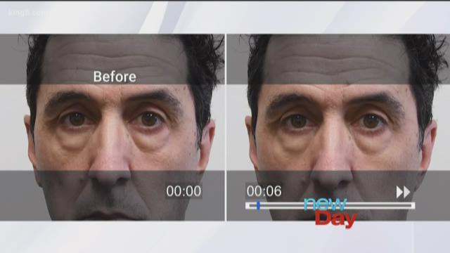 plexaderm wrinkle cream